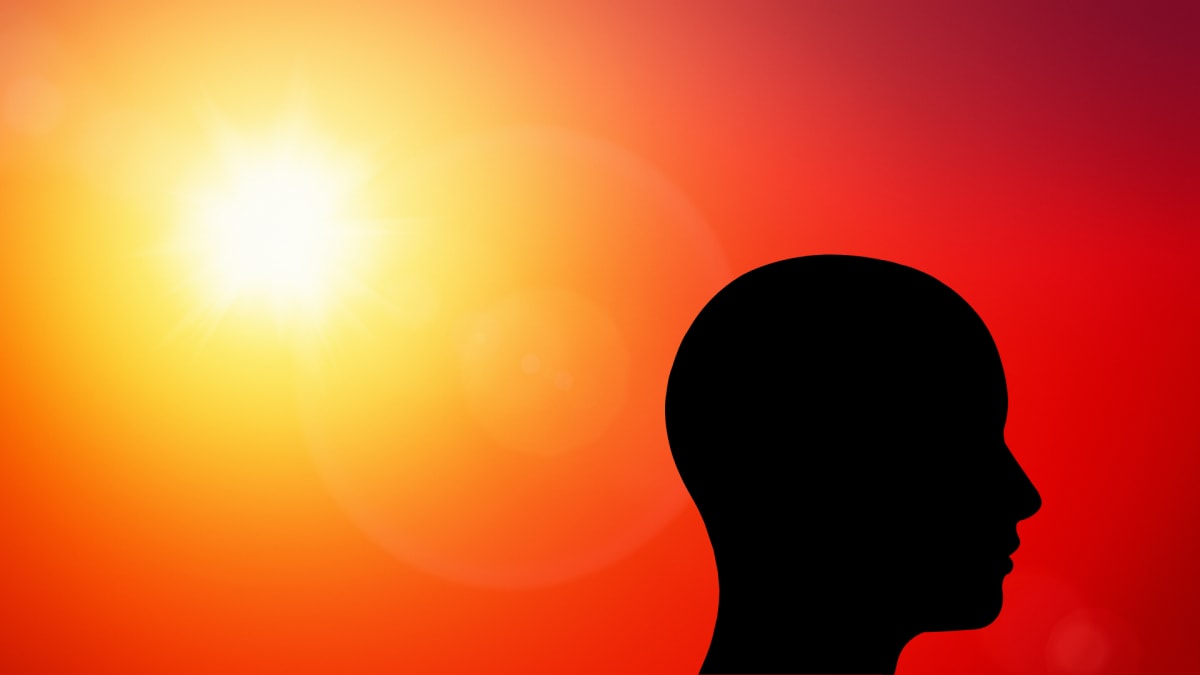 Sonnenschutz für die Kopfhaut: Ist Sonnencreme wirklich nötig?